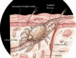 🔬 El Ácaro Sarcoptes Scabiei: Causante de la Escabiosis (Sarna Sarcóptica)