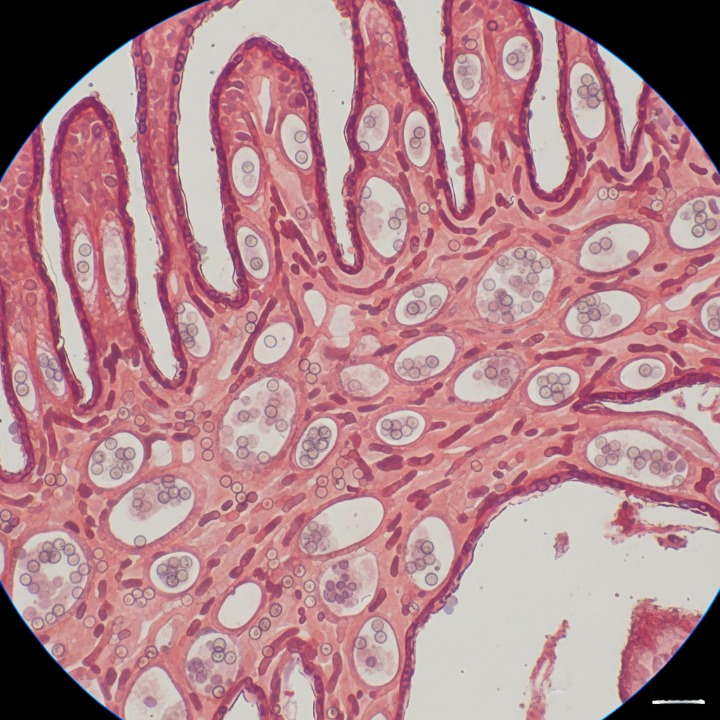 Coccidiosis en aves: Eimeria acervulina