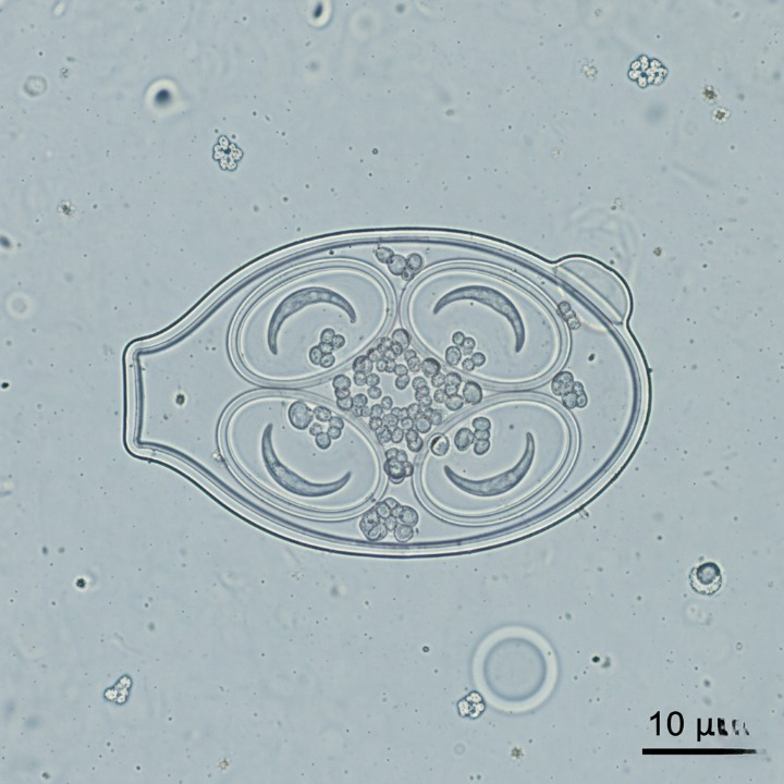 Coccidiosis en aves: Eimeria brunetti